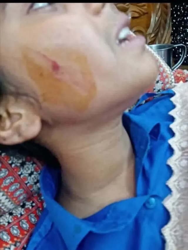 সীতাকুন্ডে সন্ত্রাসীদের ছুরিকাঘাতে স্কুল ছাত্রী আহত ছিনিয়ে নেওয়া হয়েছে গলার চেইন ও কানের দুল